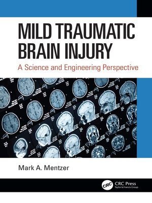 cover image of Mild Traumatic Brain Injury